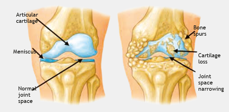 Human knee joint explained